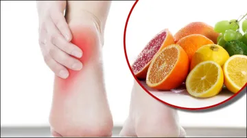 Fruits In Uric Acid- India TV Hindi