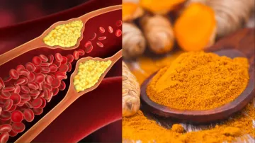 Turmeric is beneficial in high cholesterol- India TV Hindi