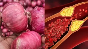 Health benefits of onion - India TV Hindi