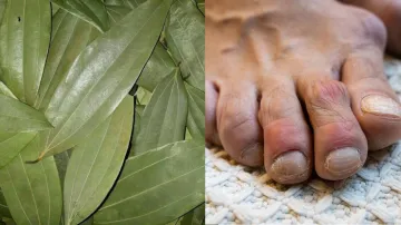 Control Uric Acid with Bay leaf- India TV Hindi