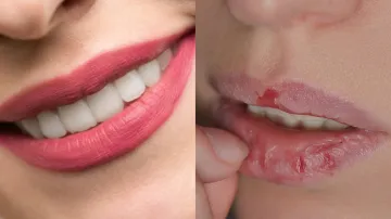 Lip Balm For Dry Lips- India TV Hindi