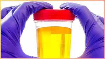 urine yellow in the morning- India TV Hindi