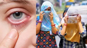 गर्मी में आंखों का कैसे करें बचाव- India TV Hindi