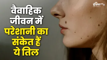 Mole on body - India TV Hindi