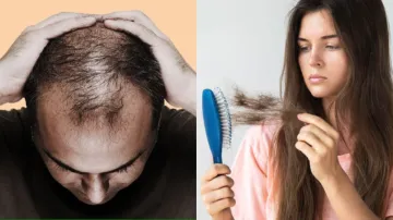 How to stop Hair fall - India TV Hindi