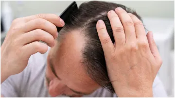 Hair Fall Problem- India TV Hindi