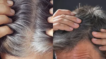 how to control grey hair at home- India TV Hindi