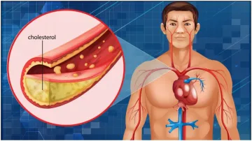 हाई कोलेस्ट्रॉल में क्या-क्या नहीं खाना चाहिए?- India TV Hindi