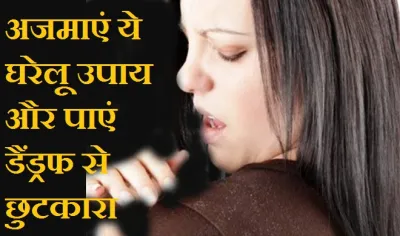 home remedies for hair dandruff - India TV Hindi