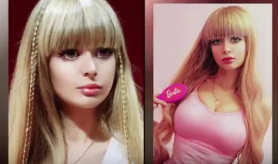 Angelica kenova before online plastic surgery