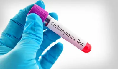 chikangunia blood test- India TV Hindi