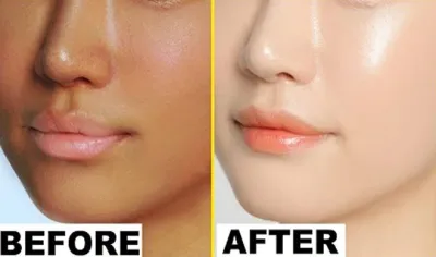 glowing skin- India TV Hindi