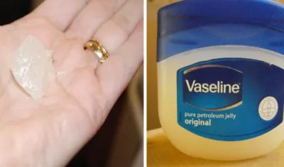 Vaseline- India TV Hindi