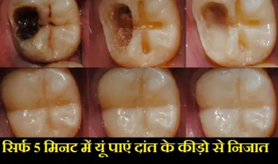 TEETH- India TV Hindi