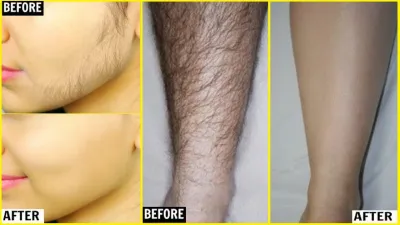 unwanted hair remover- India TV Hindi