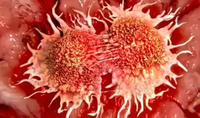 <p>cancer</p>- India TV Hindi