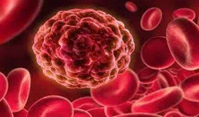 <p>blood cancer</p>- India TV Hindi