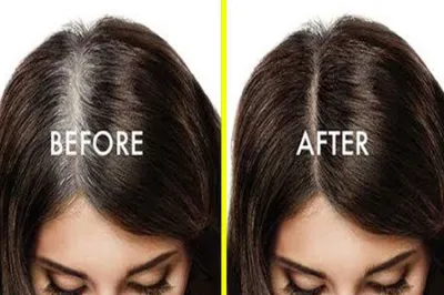 White hair treatment- India TV Hindi