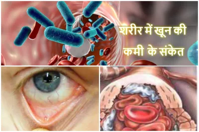 Anemia- India TV Hindi