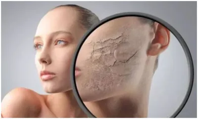 Dry and dull skin- India TV Hindi