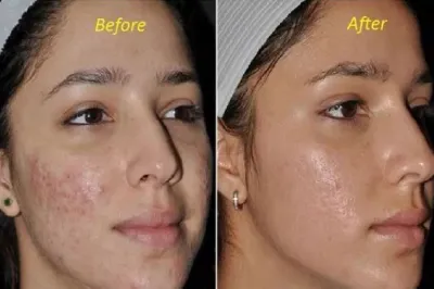 FACE SCRUB- India TV Hindi