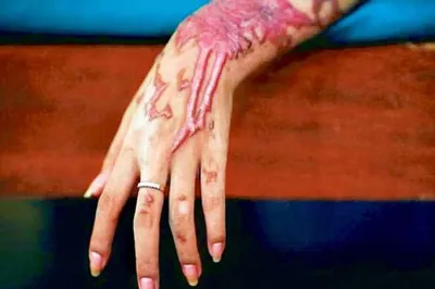 <p>Acid Attack</p>- India TV Hindi