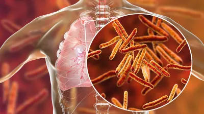 quarter of the worlds population at risk of developing tuberculosis- India TV Hindi