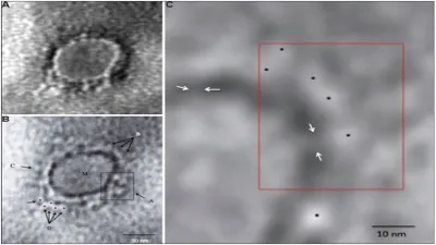 Indian Scientists Reveal First Microscopic Image Of Coronavirus From 1st Patient- India TV Hindi