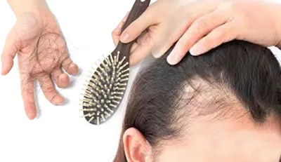 Hair fall remedy- India TV Hindi