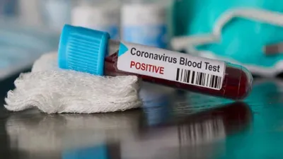 <p>Corona Virus</p>- India TV Hindi