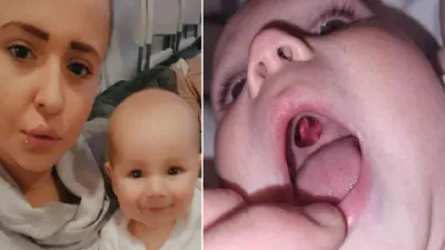Baby rushed to hospital with 'hole' in mouth - before red-faced