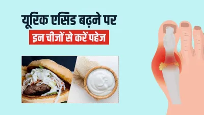 uric acid problem - India TV Hindi