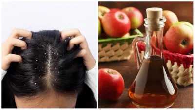 acv_for_hair- India TV Hindi