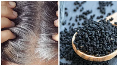 kalonji_seeds_for_grey_hair- India TV Hindi