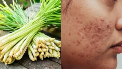  Lemongrass benefits for skin- India TV Hindi