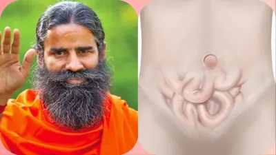  Swami ramdev tips for hernia - India TV Hindi