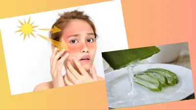 Aloevera_for_sunburn- India TV Hindi