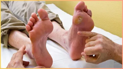 diabetic_neuropathy- India TV Hindi