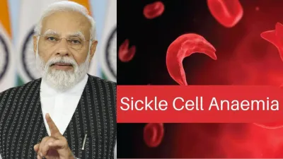 National Sickle Cell Anaemia Elimination Mission - India TV Hindi