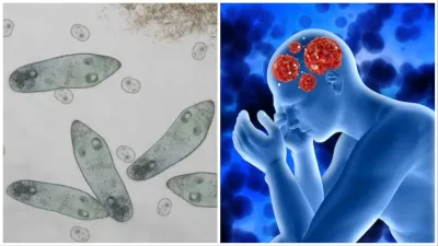 brain eating amoeba- India TV Hindi