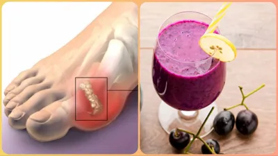 jamun_smoothie_for_uric_acid- India TV Hindi