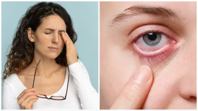 conjunctivitis?- India TV Hindi