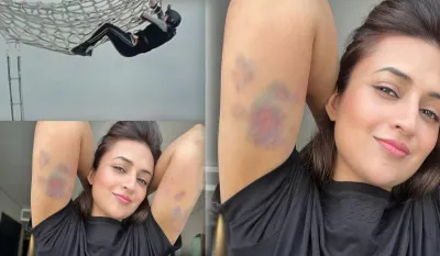 Divyanka Tripathi, Divyanka Tripathi bad condition- India TV Hindi