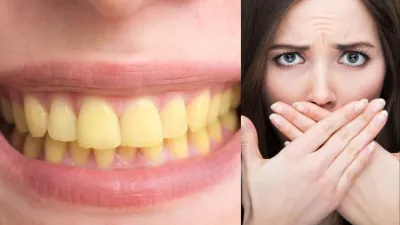 home remedies for bad breath- India TV Hindi