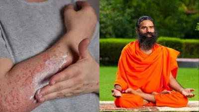 Baba Ramdev tips for autoimmune disease- India TV Hindi