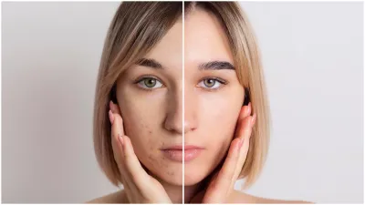 How to get rid of pigmentation?- India TV Hindi