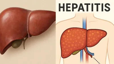 
कितना खतरनाक होता है Hepatitis, जानिए लक्षण, कारण और बचाव के तरीके?
