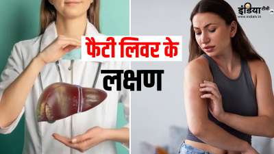 क्या आप फैटी लिवर के लक्षणों के बारे में जानते हैं? आज हम आपको त्वचा पर दिखाई देने वाले कुछ ऐसे लक्षणों के बारे में बताएंगे, जो फैटी लिवर का संकेत साबित हो सकते हैं। आपको भी इस तरह के लक्षणों को नजरअंदाज करने की गलती नहीं करनी चाहिए। क्या आप फैटी लिवर के लक्षणों के बारे में जानते हैं? आज हम आपको त्वचा पर दिखाई देने वाले कुछ ऐसे लक्षणों के बारे में बताएंगे, जो फैटी लिवर का संकेत साबित हो सकते हैं। आपको भी इस तरह के लक्षणों को नजरअंदाज करने की गलती नहीं करनी चाहिए।