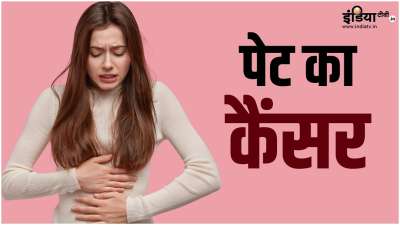 खराब लाइफस्टाइल और अनहेल्दी डाइट प्लान को फॉलो करने की वजह से पेट का कैंसर यानी गैस्ट्रिक कैंसर हो सकता है। पेट की अंदरूनी परत में शुरू होने वाला ये कैंसर मरीज की सेहत को बुरी तरह से प्रभावित कर सकता है। आइए इस कैंसर के कुछ लक्षणों के बारे में जानकारी हासिल करते हैं। खराब लाइफस्टाइल और अनहेल्दी डाइट प्लान को फॉलो करने की वजह से पेट का कैंसर यानी गैस्ट्रिक कैंसर हो सकता है। पेट की अंदरूनी परत में शुरू होने वाला ये कैंसर मरीज की सेहत को बुरी तरह से प्रभावित कर सकता है। आइए इस कैंसर के कुछ लक्षणों के बारे में जानकारी हासिल करते हैं।