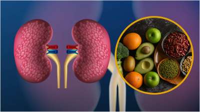 डॉक्टर आलोक कुमार झा (वरिष्ठ सलाहकार, यूरोलॉजी किडनी ट्रांसप्लांट, यथार्थ सुपर स्पेशियलिटी हॉस्पिटल फरीदाबाद) ने बताया, किडनी को स्वस्थ रखने के लिए हमें अपनी खाने&ndash;पीने की आदतों पर ध्यान देना चाहिए। सबसे पहले ज्यादा नमक और ज्यादा प्रोटीन खाने से बचें, क्योंकि यह किडनी पर बहुत दबाव डालता है।